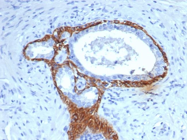 Cytokeratin 14 (KRT14) (Squamous Cell Marker) Antibody in Immunohistochemistry (Paraffin) (IHC (P))