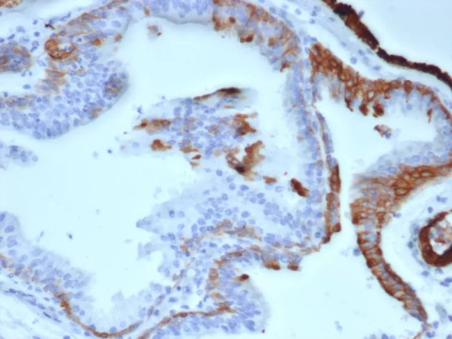 Cytokeratin 14 (KRT14) (Squamous Cell Marker) Antibody in Immunohistochemistry (Paraffin) (IHC (P))