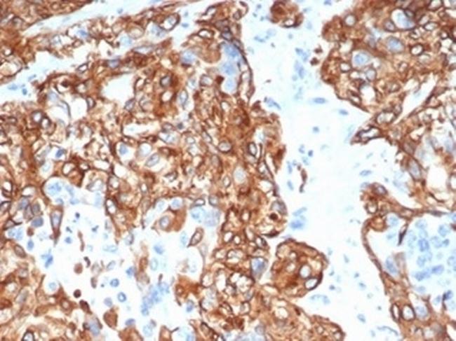 Cytokeratin 14 (KRT14) (Squamous Cell Marker) Antibody in Immunohistochemistry (Paraffin) (IHC (P))