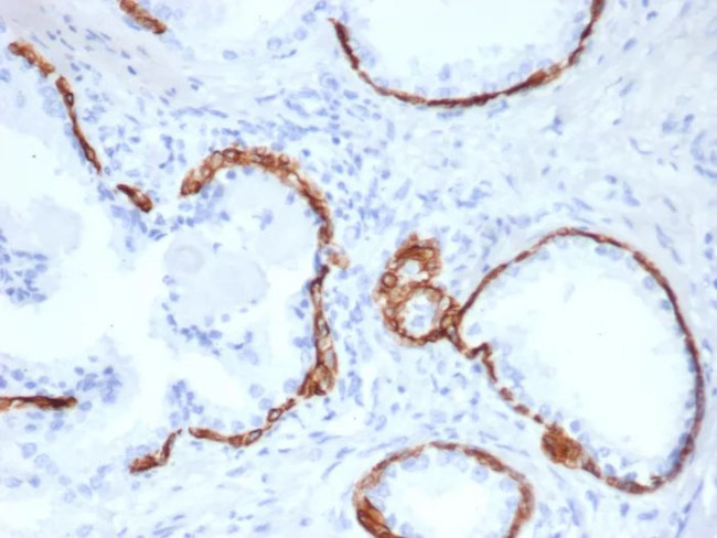 Cytokeratin 14 (KRT14) (Squamous Cell Marker) Antibody in Immunohistochemistry (Paraffin) (IHC (P))