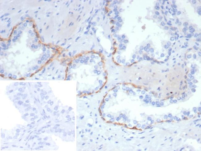 Cytokeratin 14 (KRT14) (Squamous Cell Marker) Antibody in Immunohistochemistry (Paraffin) (IHC (P))