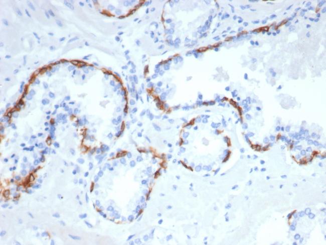 Cytokeratin 14 (KRT14) (Squamous Cell Marker) Antibody in Immunohistochemistry (Paraffin) (IHC (P))