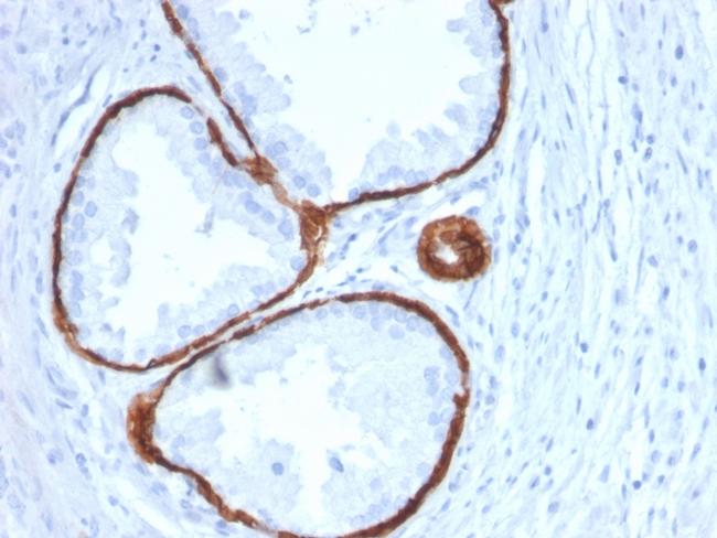 Cytokeratin 14 (KRT14) (Squamous Cell Marker) Antibody in Immunohistochemistry (Paraffin) (IHC (P))