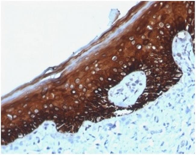 Cytokeratin 14 (KRT14) (Squamous Cell Marker) Antibody in Immunohistochemistry (Paraffin) (IHC (P))