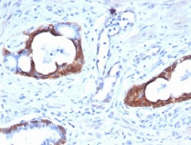 Cytokeratin 14 (KRT14) (Squamous Cell Marker) Antibody in Immunohistochemistry (Paraffin) (IHC (P))