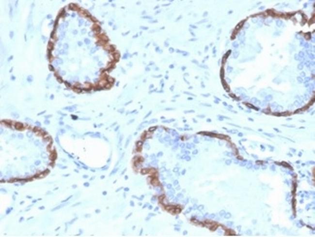 Cytokeratin 14 (KRT14) (Squamous Cell Marker) Antibody in Immunohistochemistry (Paraffin) (IHC (P))