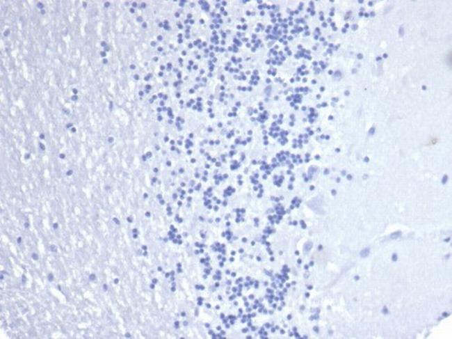 Cytokeratin 14 (KRT14) (Squamous Cell Marker) Antibody in Immunohistochemistry (Paraffin) (IHC (P))