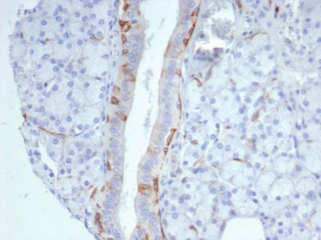 Cytokeratin 14 (KRT14) (Squamous Cell Marker) Antibody in Immunohistochemistry (Paraffin) (IHC (P))