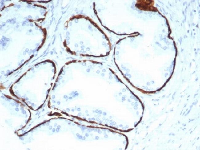 Cytokeratin 14 (KRT14) (Squamous Cell Marker) Antibody in Immunohistochemistry (Paraffin) (IHC (P))