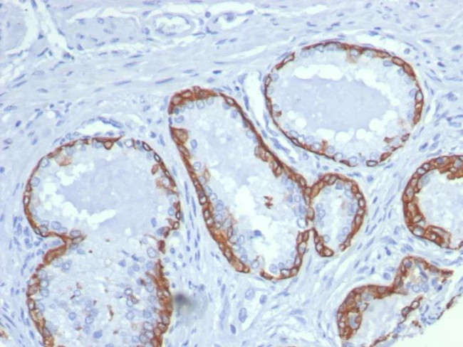 Cytokeratin 14 (KRT14) (Squamous Cell Marker) Antibody in Immunohistochemistry (Paraffin) (IHC (P))