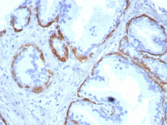 Cytokeratin 14 (KRT14) (Squamous Cell Marker) Antibody in Immunohistochemistry (Paraffin) (IHC (P))