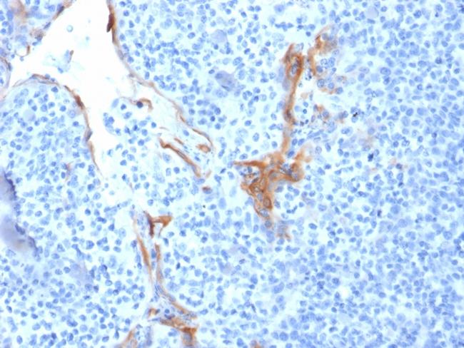 Cytokeratin 16 (KRT16) (Suprabasal Keratinocyte Marker) Antibody in Immunohistochemistry (Paraffin) (IHC (P))