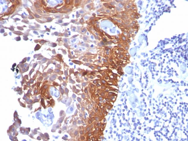 Cytokeratin 17 (KRT17) (Basal Epithelial Marker) Antibody in Immunohistochemistry (Paraffin) (IHC (P))