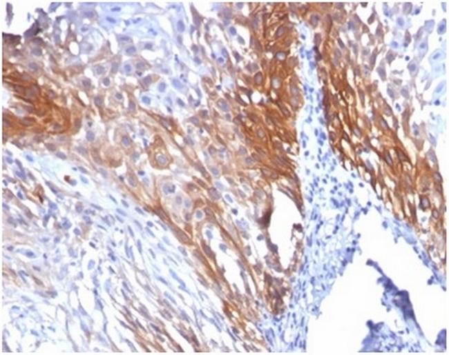 Cytokeratin 17 (CK17) (Basal Epithelial Marker) Antibody in Immunohistochemistry (Paraffin) (IHC (P))