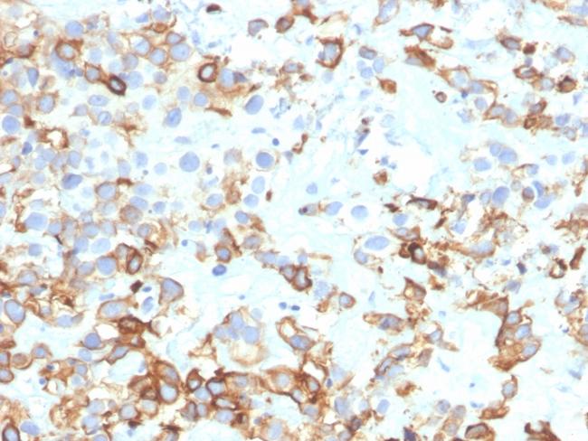 Cytokeratin 17 (CK17) (Basal Epithelial Marker) Antibody in Immunohistochemistry (Paraffin) (IHC (P))