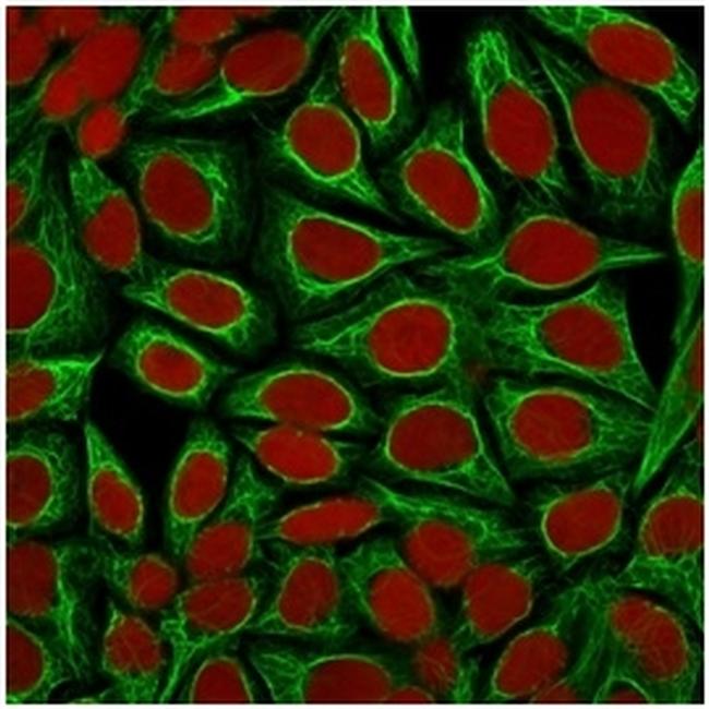 Cytokeratin 18 (KRT18) Antibody in Immunocytochemistry (ICC/IF)