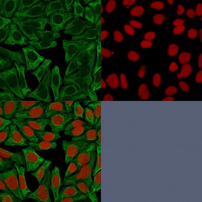 Cytokeratin 18 (KRT18) Antibody in Immunocytochemistry (ICC/IF)