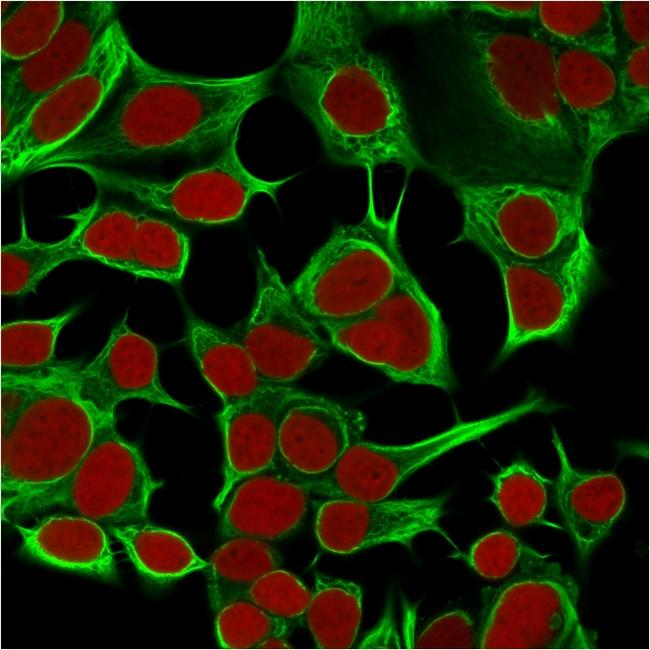 Cytokeratin 18 (KRT18) Antibody in Immunocytochemistry (ICC/IF)