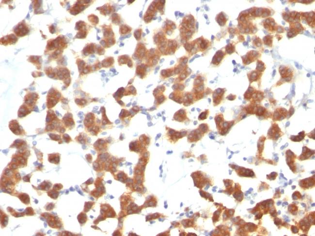 Cytokeratin 18 (KRT18) Antibody in Immunohistochemistry (Paraffin) (IHC (P))