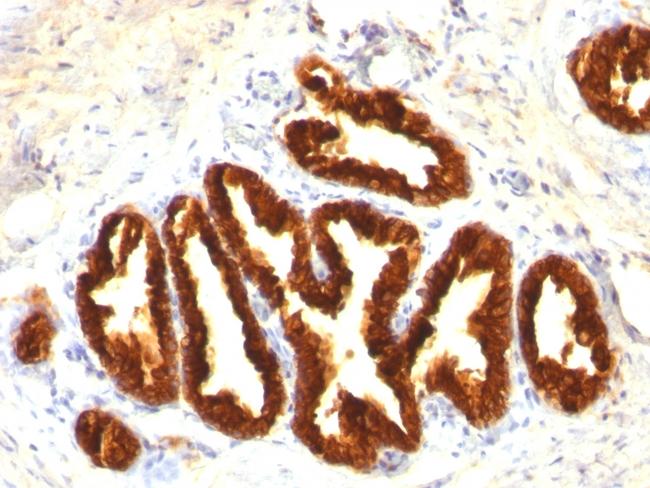 Cytokeratin 18 (KRT18) Antibody in Immunohistochemistry (Paraffin) (IHC (P))