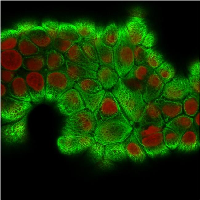 Cytokeratin 18 (KRT18) Antibody in Immunocytochemistry (ICC/IF)