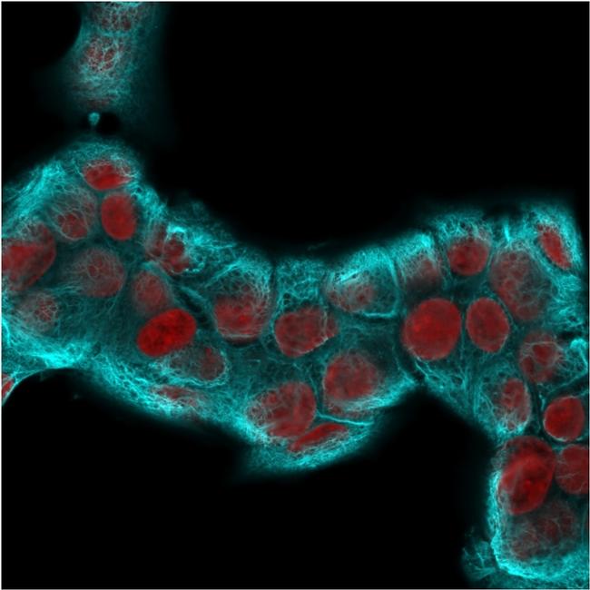 Cytokeratin 18 (KRT18) Antibody in Immunocytochemistry (ICC/IF)