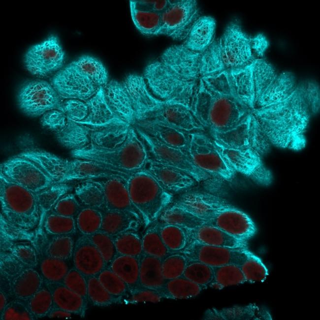 Cytokeratin 19 (KRT19) (Pancreatic Stem Cell Marker) Antibody in Immunocytochemistry (ICC/IF)