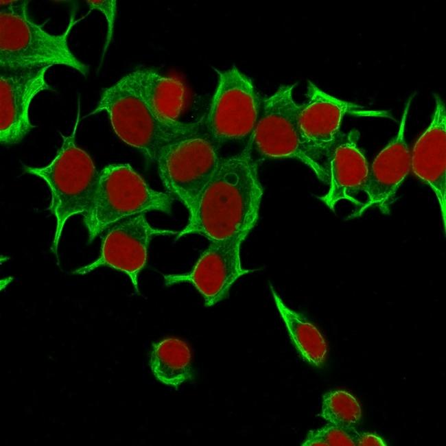 Cytokeratin 19 (KRT19) (Pancreatic Stem Cell Marker) Antibody in Immunocytochemistry (ICC/IF)