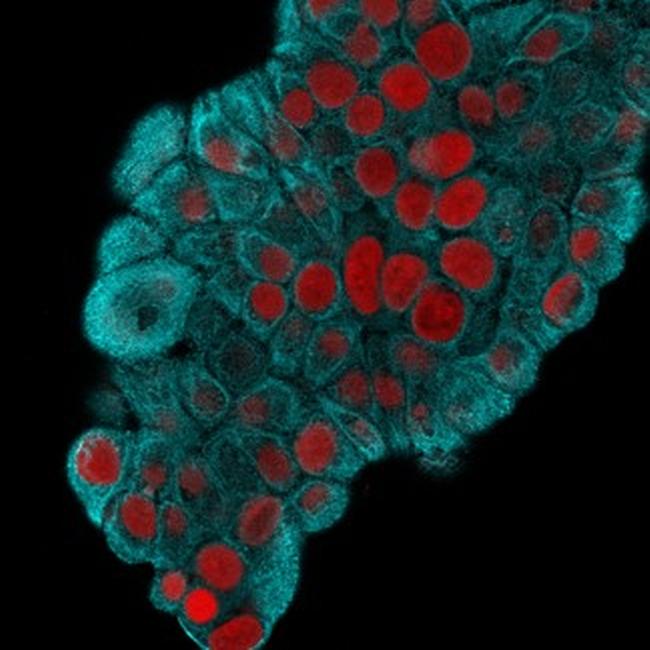 Cytokeratin 19 (Pancreatic Stem Cell Marker) Antibody in Immunocytochemistry (ICC/IF)