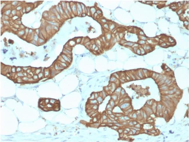 Cytokeratin 19 (KRT19) Antibody in Immunohistochemistry (Paraffin) (IHC (P))