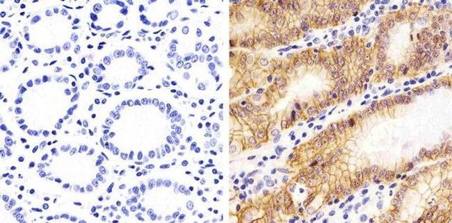 Claudin 18 Antibody in Immunohistochemistry (Paraffin) (IHC (P))