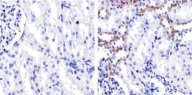 Claudin 10 Antibody in Immunohistochemistry (Paraffin) (IHC (P))