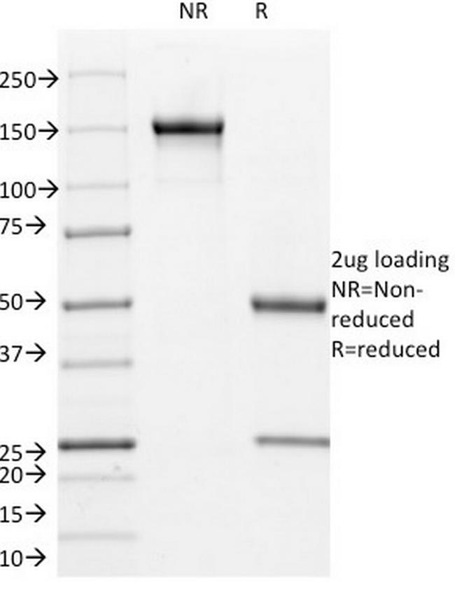 CD171/NCAM-L1 (Axonal Marker) Antibody in SDS-PAGE (SDS-PAGE)