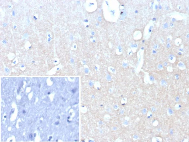 CD171/NCAM-L1 (L1 Cell Adhesion Molecule) Antibody in Immunohistochemistry (Paraffin) (IHC (P))