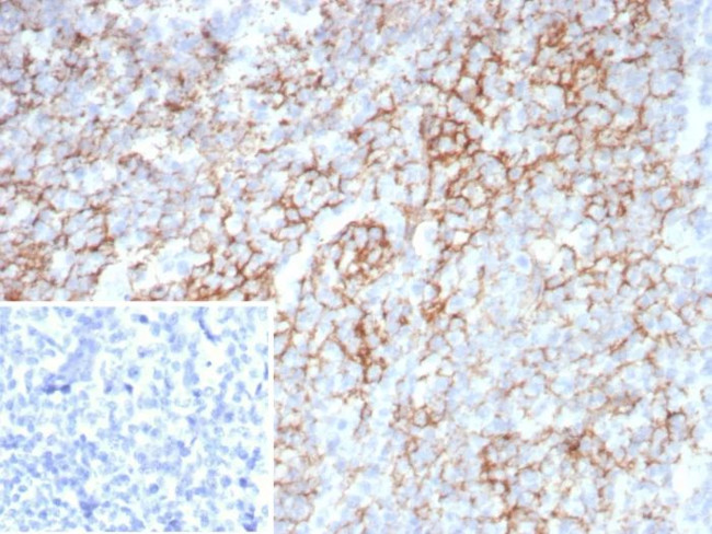 Lymphocyte Activation Gene 3 (LAG-3) (Negative Checkpoint Regulator) Antibody in Immunohistochemistry (Paraffin) (IHC (P))