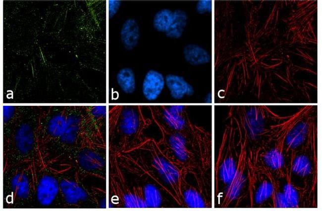 PPAP2B Antibody in Immunocytochemistry (ICC/IF)