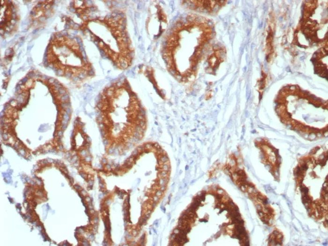 CD107a/Lysosomal associated membrane protein 1 (LAMP1) Antibody in Immunohistochemistry (Paraffin) (IHC (P))