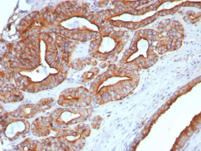 CD107a/Lysosomal associated membrane protein 1 (LAMP1) Antibody in Immunohistochemistry (Paraffin) (IHC (P))