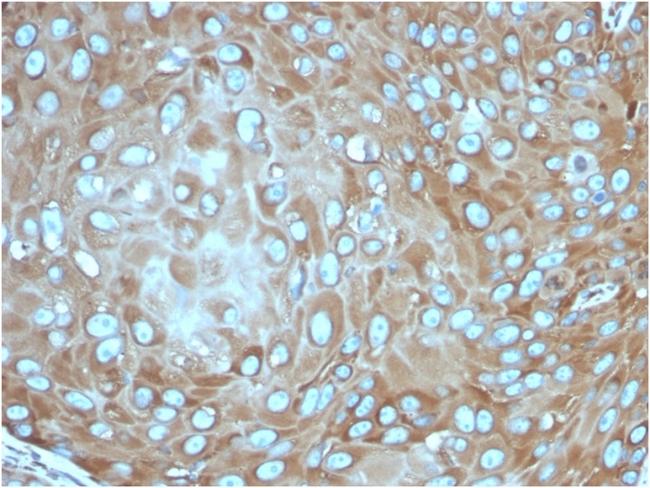 Laminin Receptor/ RPSA (Marker of Metastatic Potential) Antibody in Immunohistochemistry (Paraffin) (IHC (P))