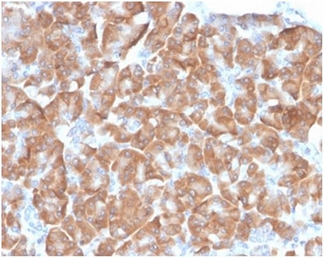 Laminin Receptor/ RPSA (Marker of Metastatic Potential) Antibody in Immunohistochemistry (Paraffin) (IHC (P))