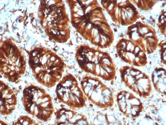 Stathmin 1/STMN1 Antibody in Immunohistochemistry (Paraffin) (IHC (P))