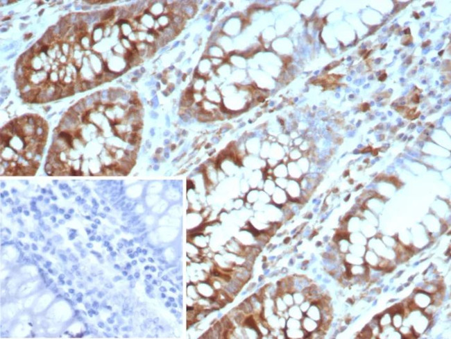 Stathmin 1/STMN1 Antibody in Immunohistochemistry (Paraffin) (IHC (P))