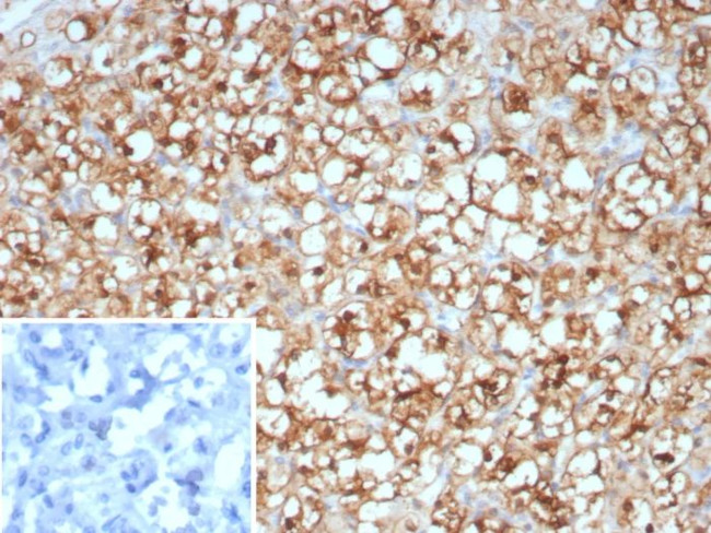 Stathmin 1/STMN1 Antibody in Immunohistochemistry (Paraffin) (IHC (P))