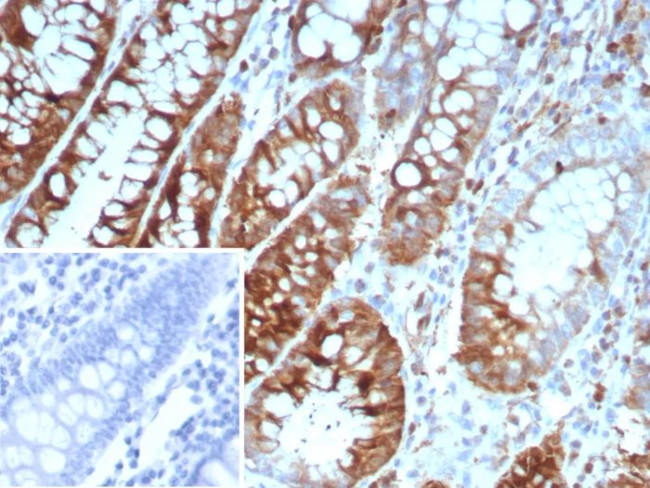 Stathmin 1/STMN1 Antibody in Immunohistochemistry (Paraffin) (IHC (P))