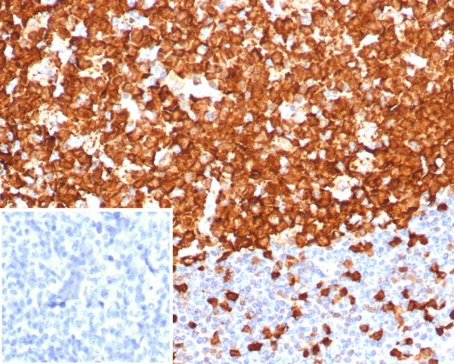 Stathmin 1/STMN1 Antibody in Immunohistochemistry (Paraffin) (IHC (P))