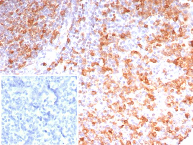 Stathmin 1/STMN1 Antibody in Immunohistochemistry (Paraffin) (IHC (P))