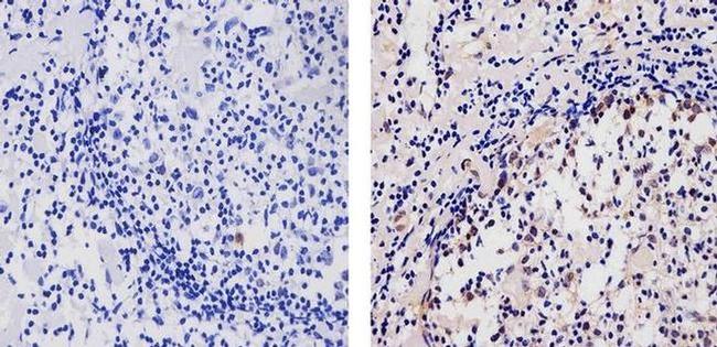 AID Antibody in Immunohistochemistry (Paraffin) (IHC (P))