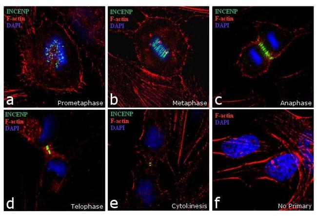 INCENP Antibody in Immunocytochemistry (ICC/IF)