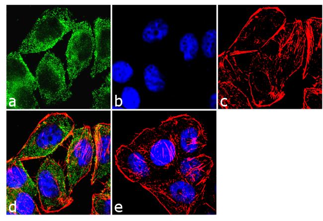 beta Arrestin 1 Antibody in Immunocytochemistry (ICC/IF)