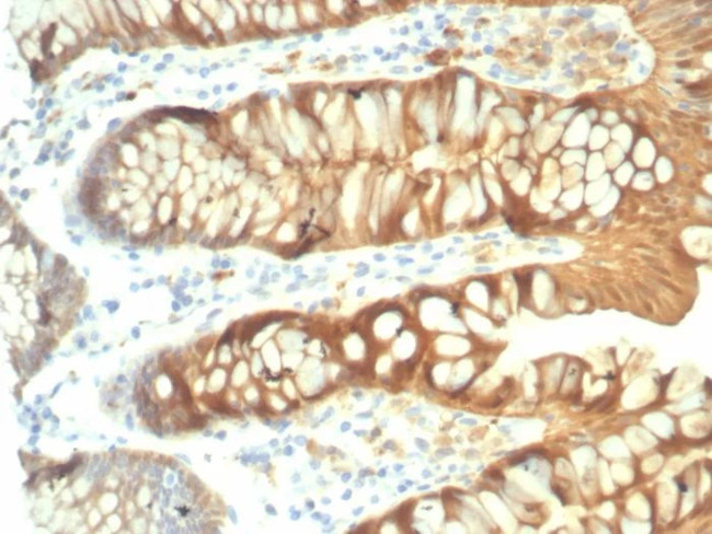 Galectin-3 (LGALS3) (Thyroid Cell Marker) Antibody in Immunohistochemistry (Paraffin) (IHC (P))